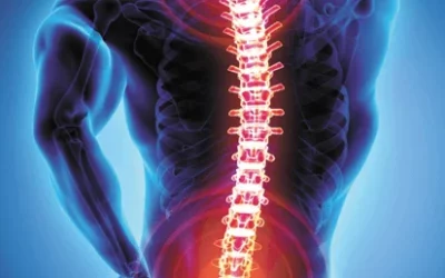 Did You Know? Your X-Ray May Not Explain Your Low Back Pain